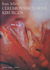 Cerebrovaskularna kirurgija